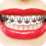 Real Braces Teeth 1.2